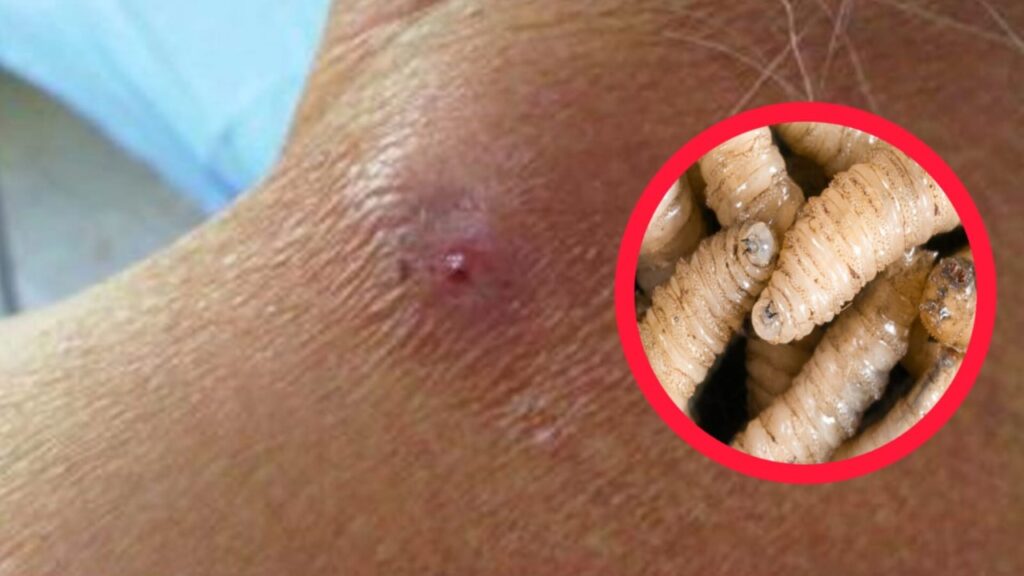 Gusano barrenador alcanza nueve casos en Hidalgo y enciende focos rojos sanitarios