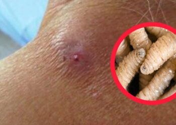 Gusano barrenador alcanza nueve casos en Hidalgo y enciende focos rojos sanitarios