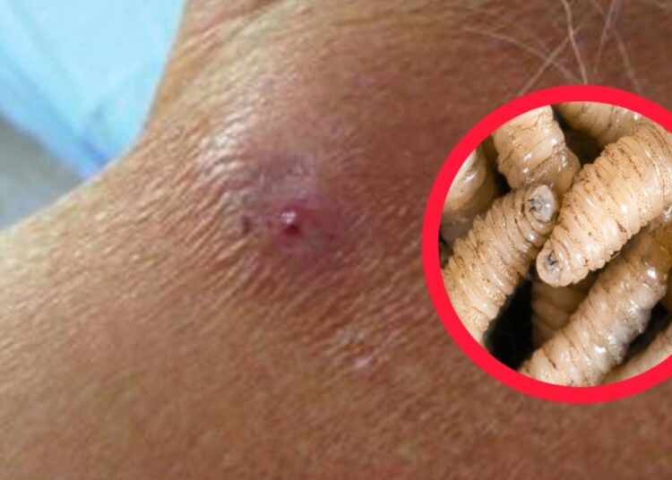 Gusano barrenador alcanza nueve casos en Hidalgo y enciende focos rojos sanitarios