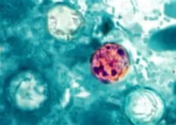 Reino Unido emite alerta sanitaria por casos de ciclosporiasis en México