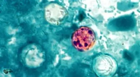 Reino Unido emite alerta sanitaria por casos de ciclosporiasis en México